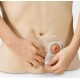 12070 - UNID FITA ADESIVA ELAST FORMATO C COLOSTOMIA (BRAVA) CX/20 - COLOPLAST